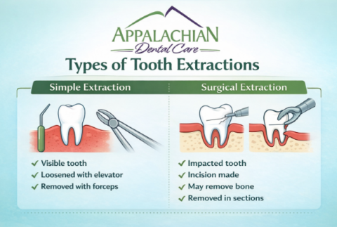 Simple & Surgical Extractions | Appalachian Dental Care