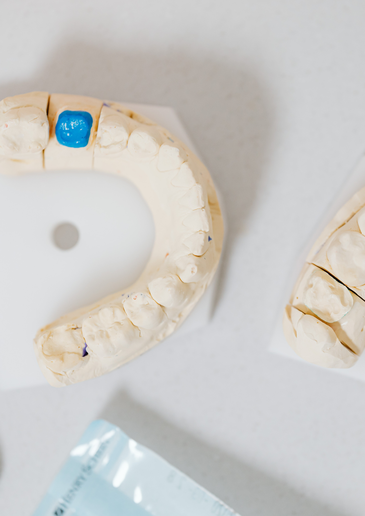 tooth colored fillings matter